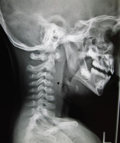 X-rays are often pretty expensive, but they range in price from about $75 to $500. The costs for any specific X-ray will vary based on the number of views required, whether or not sedation is required, and individual differences in veterinary pricing. X-rays are used to investigate a variety of health problems.